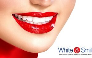 White&Smile 3.jpg